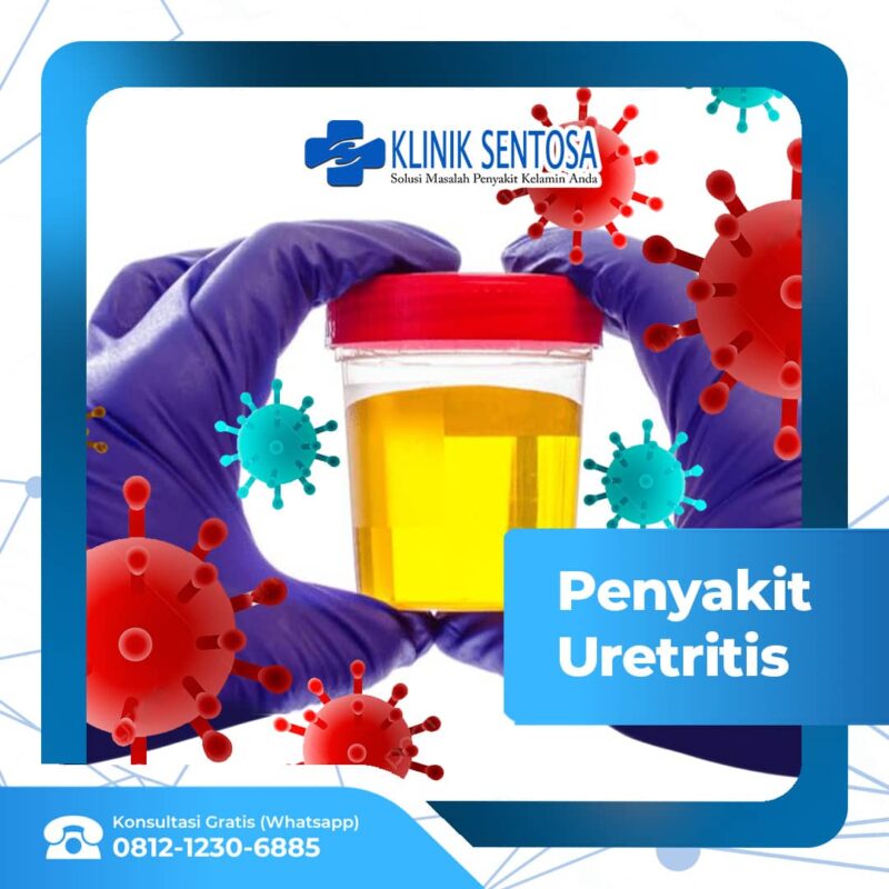 Penyakit Uretritis Penyebab Gejala Dan Pengobatan Klinik Utama Sentosa