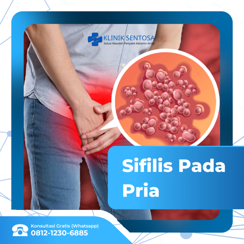 Ciri Ciri Sifilis Pada Pria Apa Saja Klinik Utama Sentosa 4148