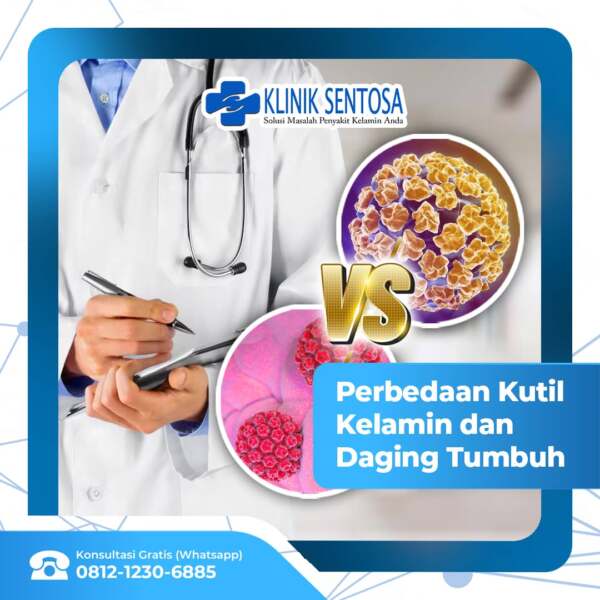 Ketahui Perbedaan Kutil Kelamin Dan Daging Tumbuh