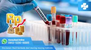 Tes untuk mendeteksi infeksi klamidia biasanya melibatkan pengambilan sampel dari area yang terinfeksi atau pemeriksaan darah.