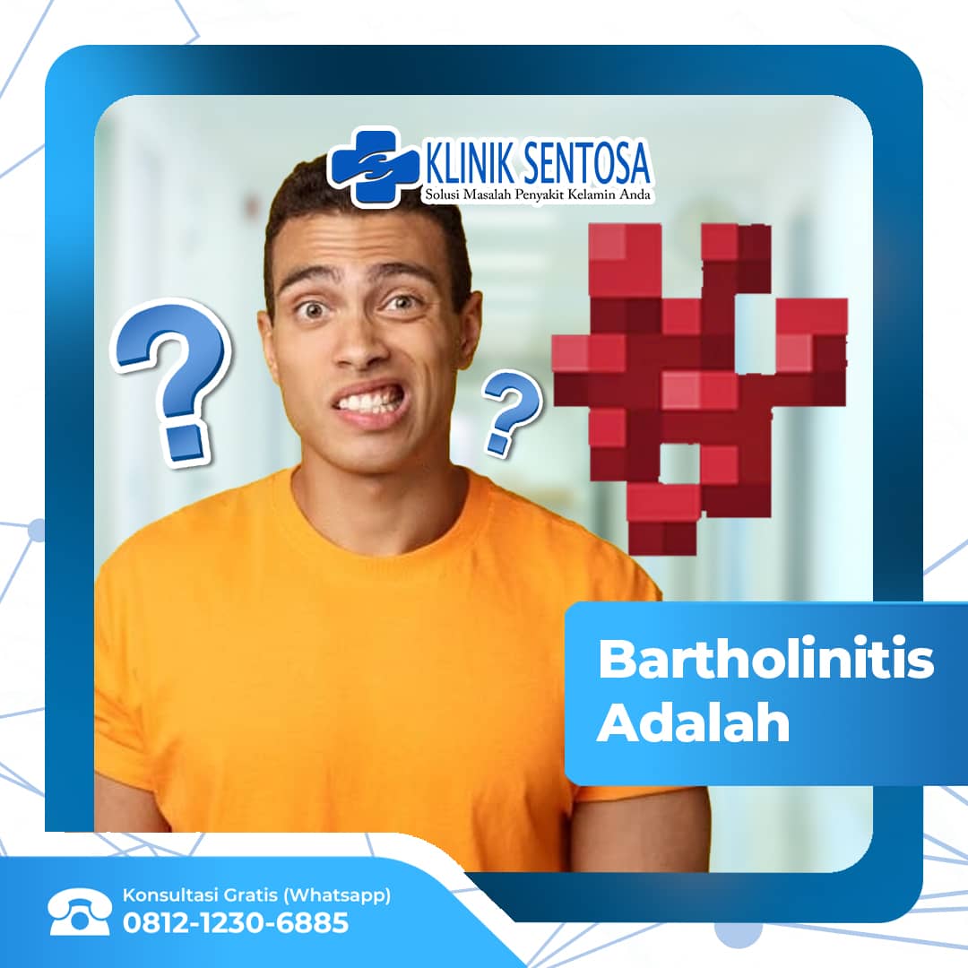 Bartholinitis (Kista Bartholin) Penjelasan, Penyebab, Hingga Pengobatan