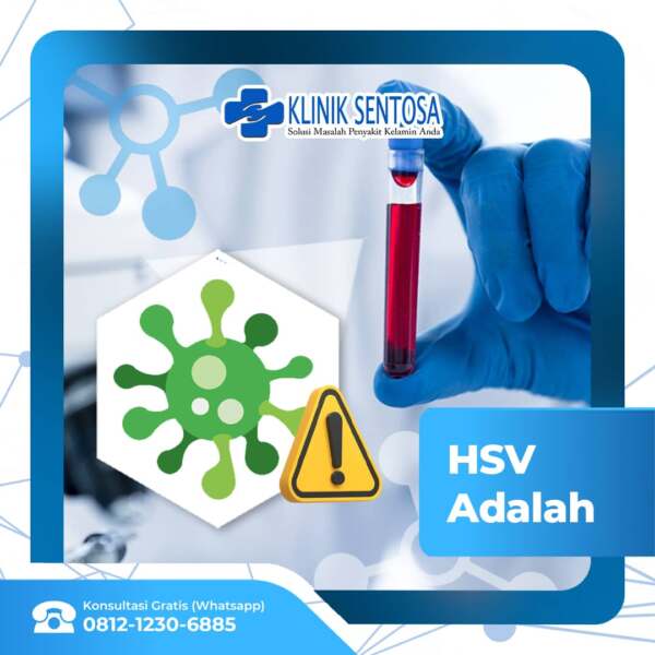 Kenalan Yuk Dengan Virus Herpes Simpleks (HSV) – Klinik Utama Sentosa