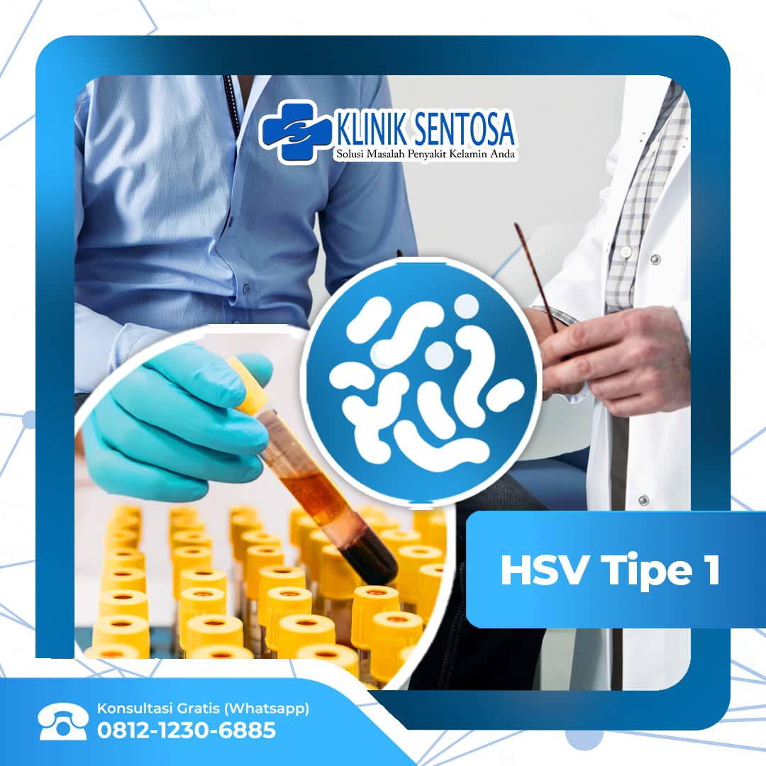 Mengenal Lebih Dalam Herpes Simplex Virus (Hsv) Tipe 1