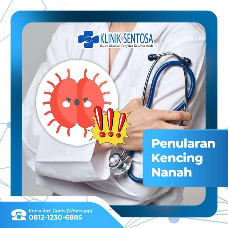 Perlu Diketahui Beragam Cara Penularan Kencing Nanah Klinik Utama Sentosa