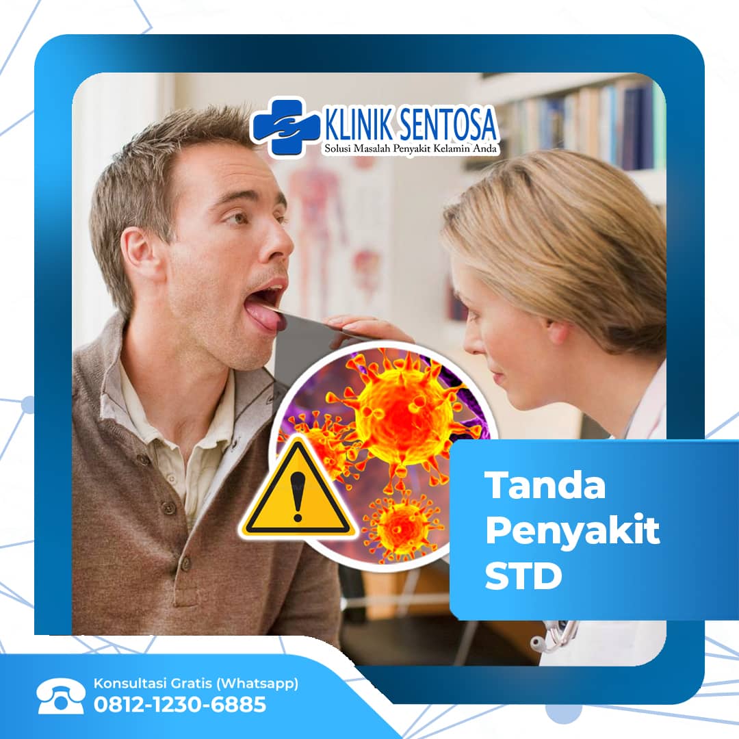 Tanda Sexually Transmitted Disease atau STD (Penyakit Kelamin)