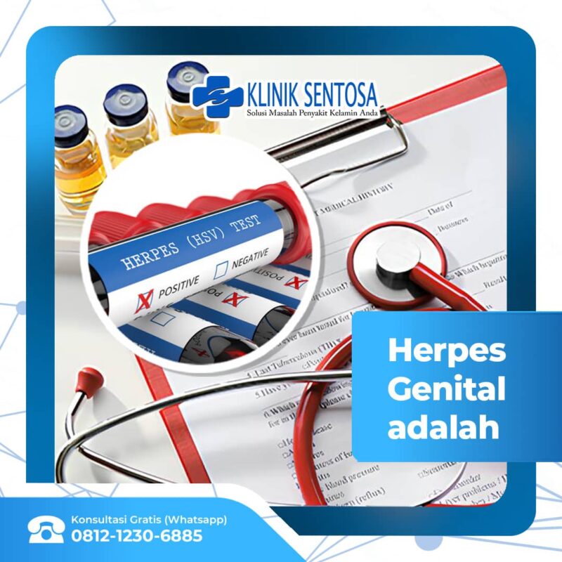 Herpes Genital: Penyebab, Gejala, Dan Pengobatan – Klinik Utama Sentosa