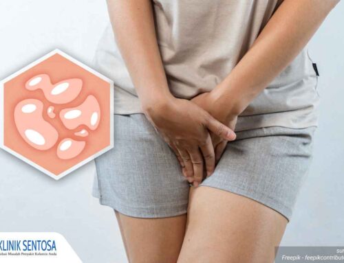 Kebiasaan Ini Ternyata Bisa Bikin Lepuh Herpes Genital Menyebar Lho, Jangan Abaikan!