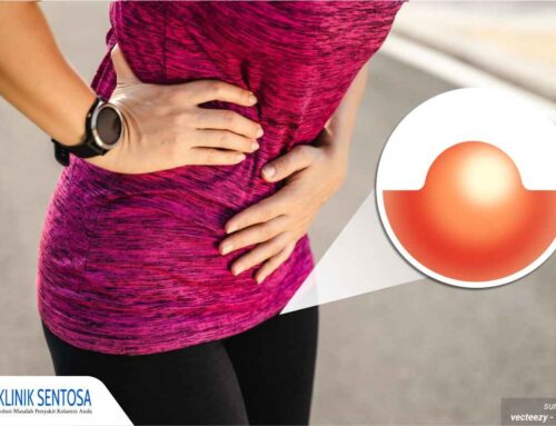Sinyal Merah! Benjolan di Bibir Vagina Dengan Ciri Ini Perlu Diobati Segera