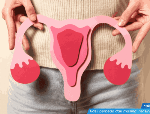 Strategi EFektif Mengatasi Kencing Nanah pada Wanita, Ini yang Harus Diperhatikan!