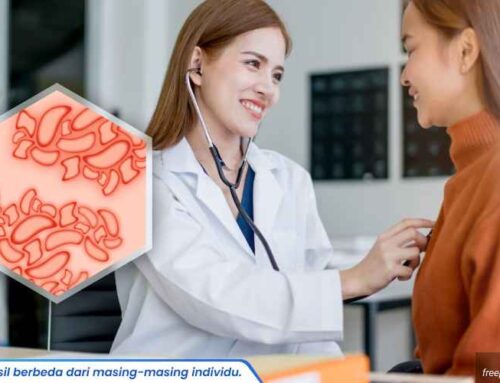 Terbukti Ampuh! Ini Dia Metode Pengobatan Kutil Kelamin yang Direkomendasikan Dokter