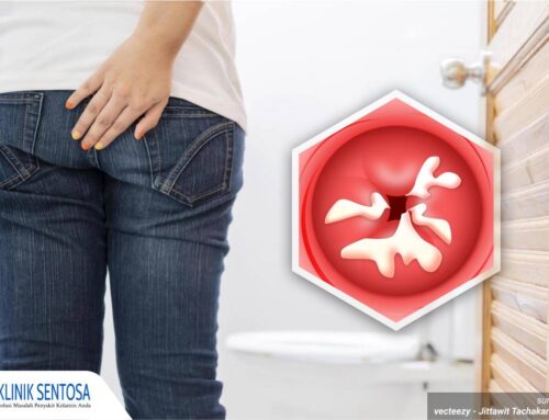 5 Gejala Awal Keputihan Akibat Infeksi, Wanita Wajib Tahu!