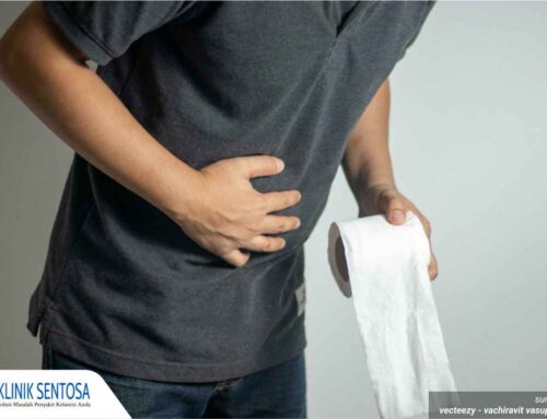 Cara Membedakan Penis Bernanah Akibat Gonore dan Balanitis, Simak!