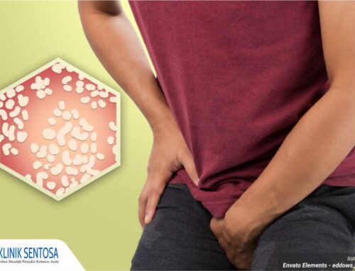 Sering Gatal Tak Tertahankan? Awas, Bisa Jadi Infeksi Jamur pada Penis!