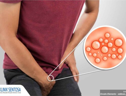 Muncul Lepuhan Gatal di Kelamin, Infeksi Jamur atau Herpes Genital? Ini Penyebabnya!
