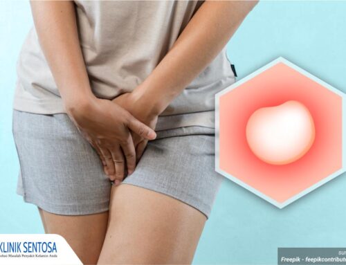 Muncul Benjolan di Kemaluan Wanita Disertai Rasa Gatal? Cari Tahu Penyebabnya!