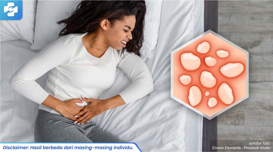 herpes di kelamin wanita 2_5_11zon