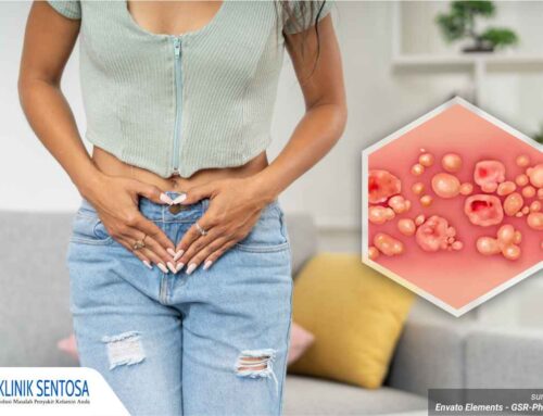 Iritasi atau Infeksi? Kenali Berbagai Faktor Penyebab Bibir Vagina Gatal di Sini!