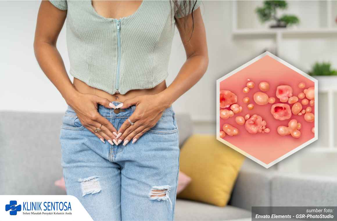 bibir vagina gatal 1_6_11zon