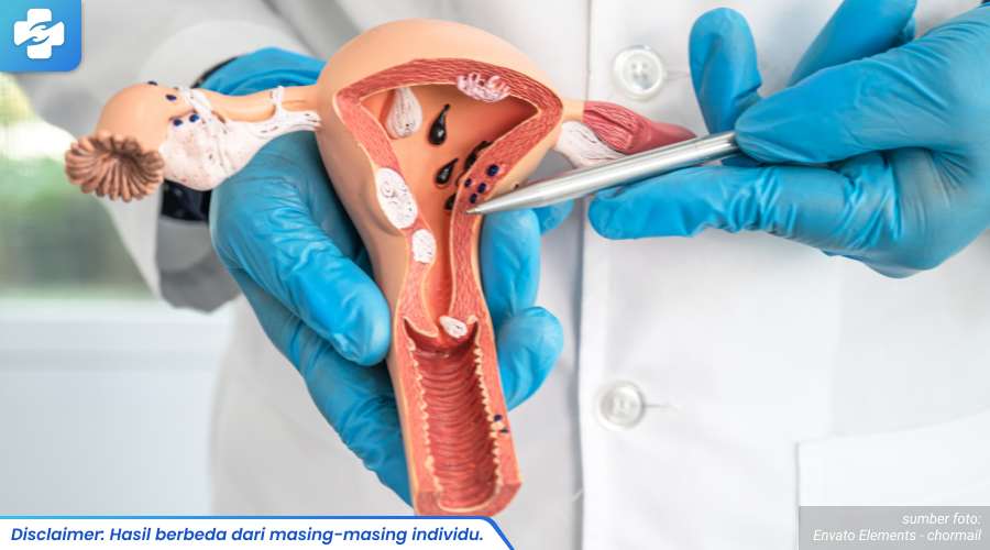 bintik putih di bibir vagina 2_3_11zon