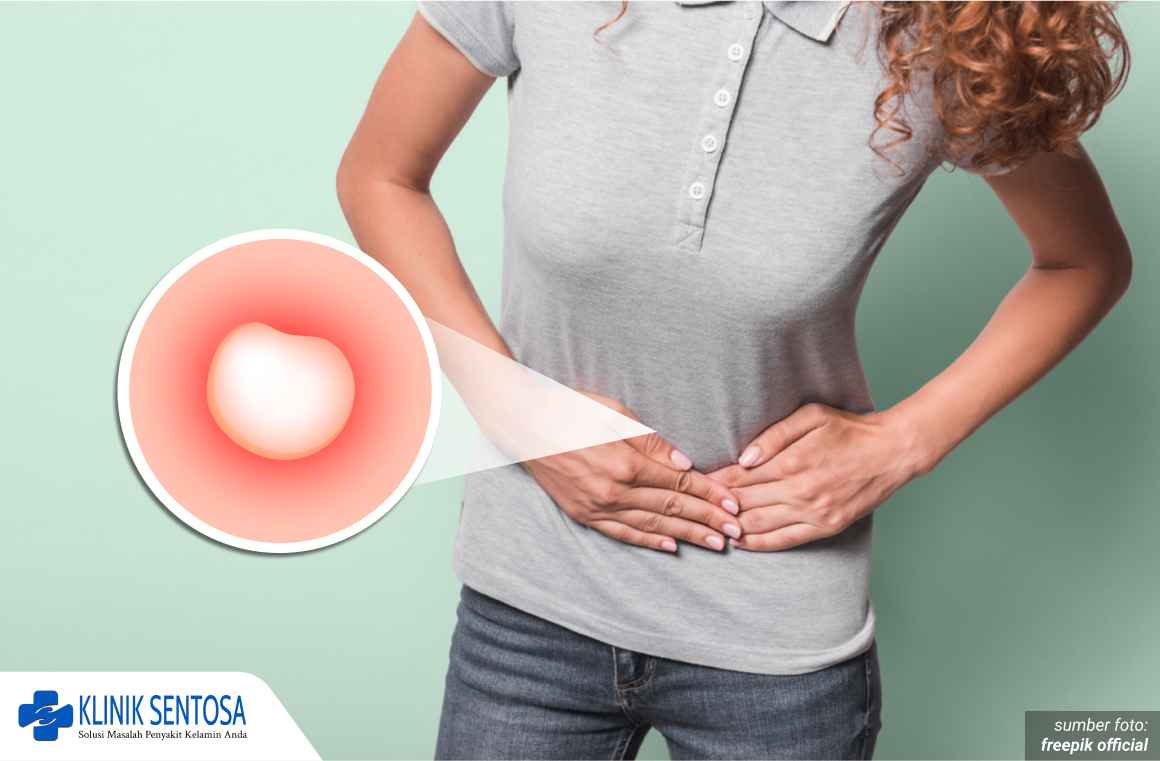 kista bartholin pada remaja 1_2_11zon