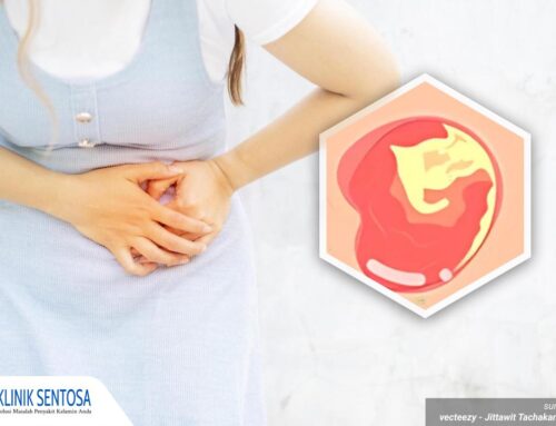 Cara Cepat Mengobati Keputihan Gatal dan Berbau Tak Sedap, Wanita Harus Tahu!