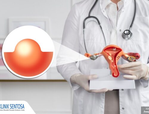 Wanita Harus Tahu! Ini Penyebab Benjolan Kecil di Vagina yang Berbahaya Jika Dibiarkan