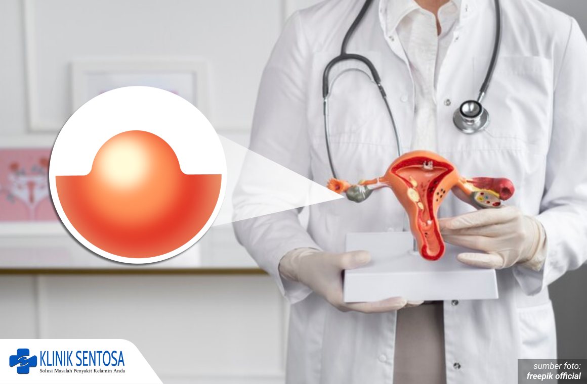 benjolan kecil di vagina 1_2_11zon