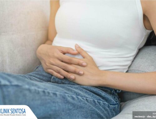 3 Fakta Penting Tentang Penyakit Raja Singa pada Wanita yang Harus Diketahui, Jangan Abaikan!