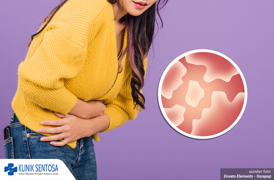 infeksi jamur miss v 1_3_11zon