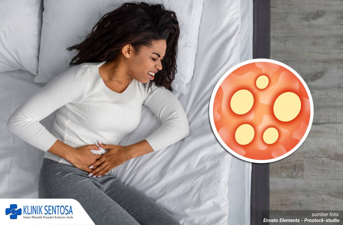 keputihan sifilis pada wanita 1_3_11zon