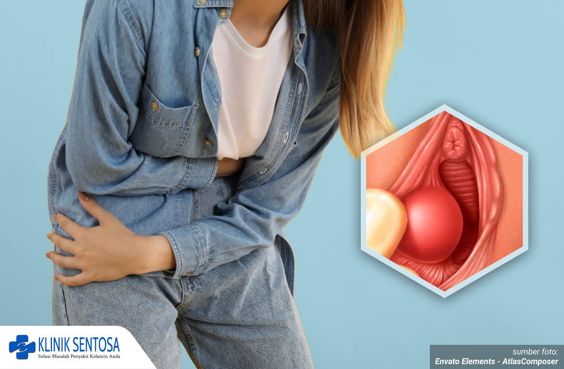 penderita kista bartholin 1_5_11zon
