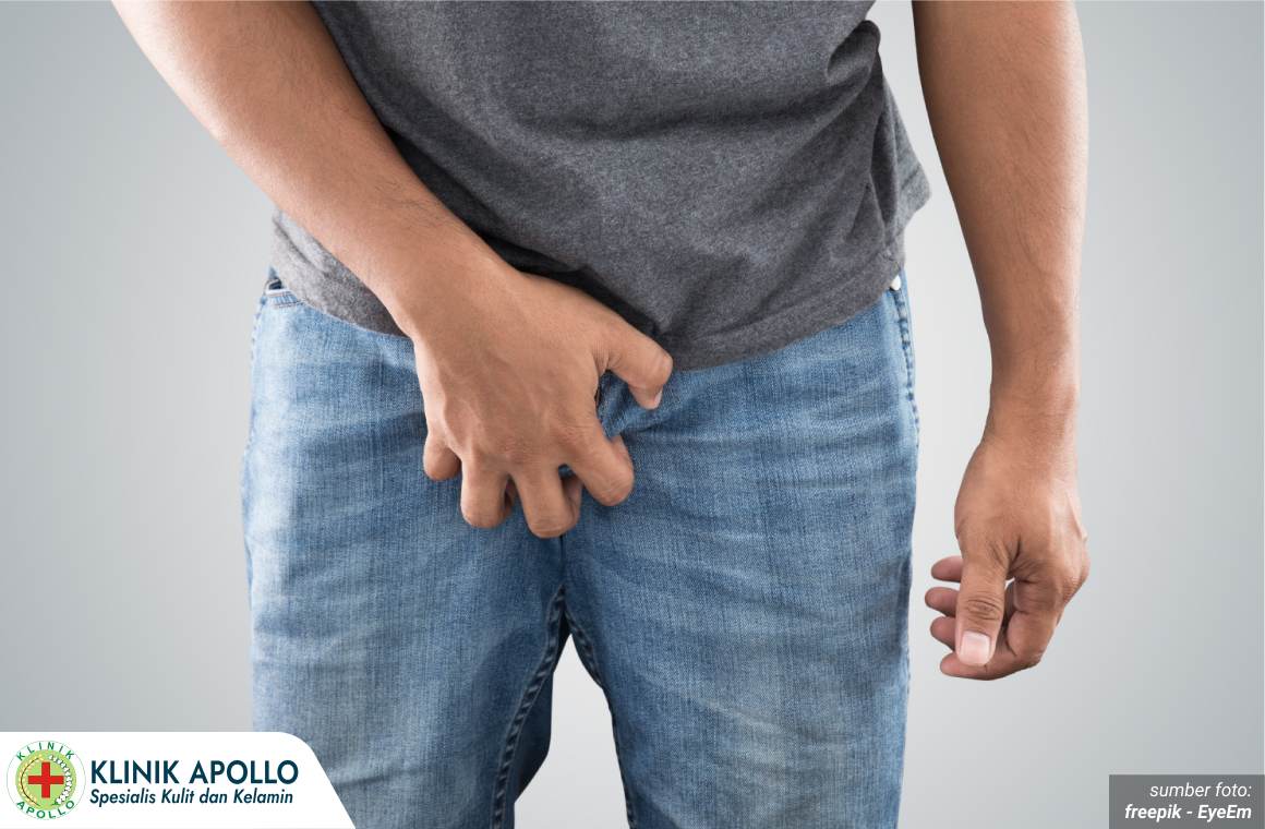 balanitis jamur 1_5_11zon