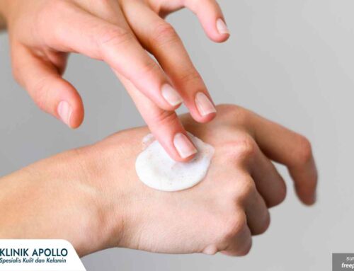 Bau Menyengat dan Gatal? Ini Cara Obati Keputihan Abnormal yang Benar