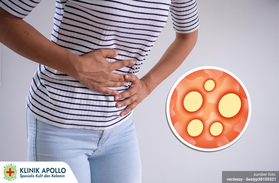 luka pada kelamin 1_5_11zon luka pada kelamin 1_5_11zon