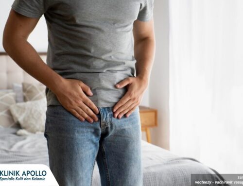 Pengobatan Balanitis Berdasarkan Penyebabnya, Jangan Asal Minium Obat!