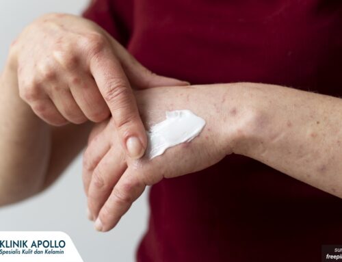 Sudah Pakai Salep Kok Lepuh Herpes Genital Tidak Kunjung Kering? Mungkin Ini Pemicunya!