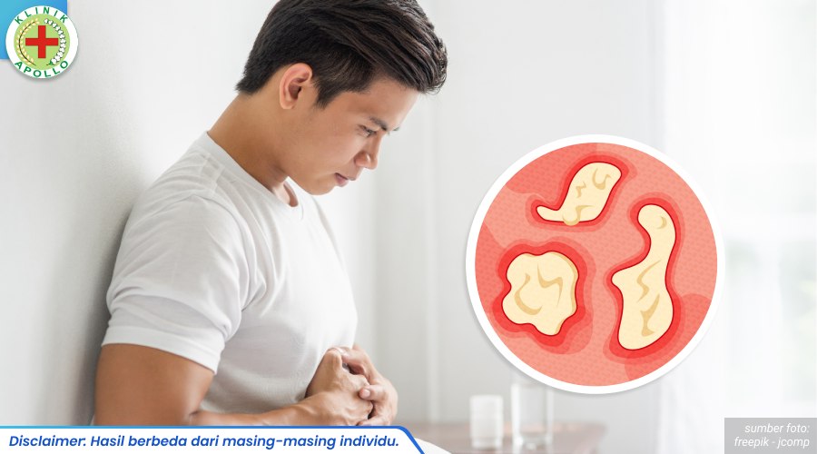 sifilis pada kelamin pria 2_6_11zon