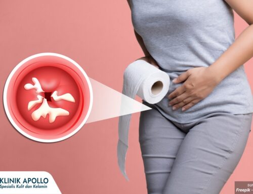 Ingin Lebih Kencang dan Percaya Diri? Ini Cara Merapatkan Daerah Kewanitaan yang Aman!