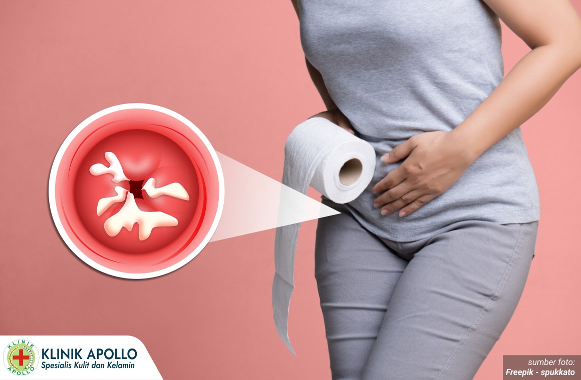 CARA MERAPATKAN DAERAH KEWANITAAN 1