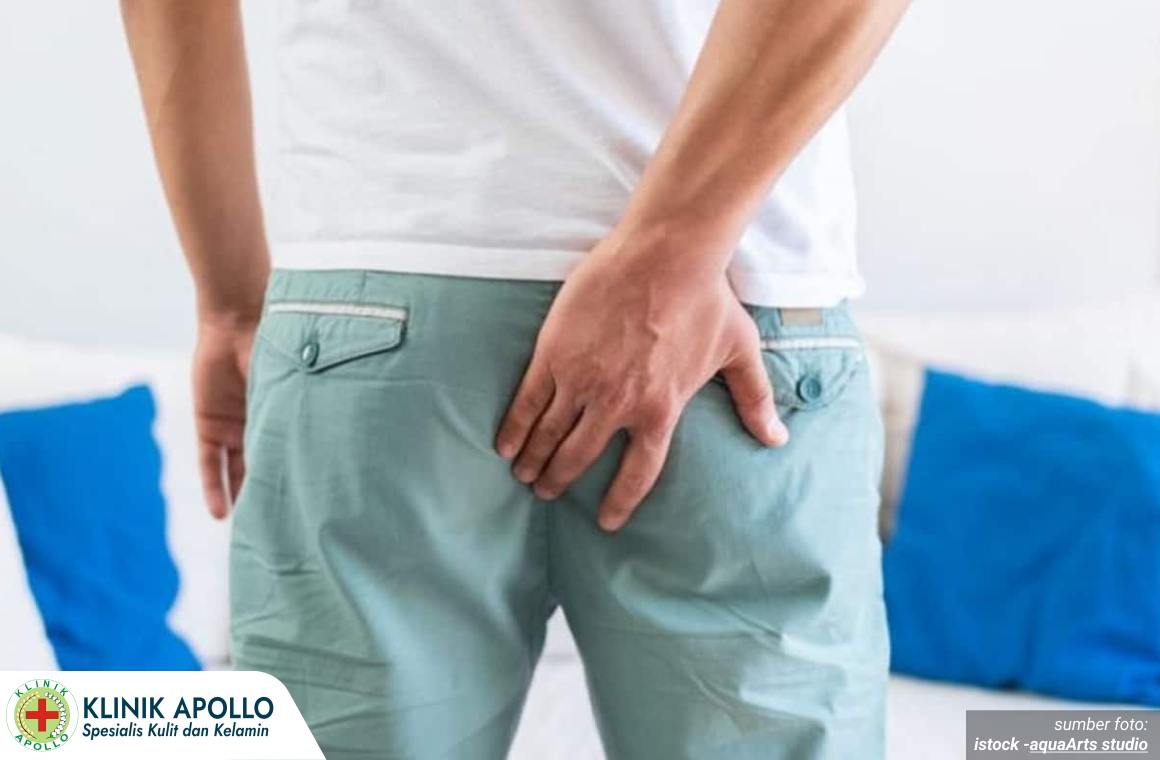 cara hilangkan kutil di anus 1 - klinikutamasentosa.net_4_11zon