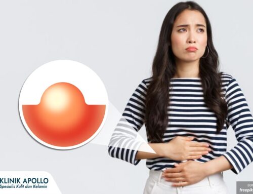 Obat atau Operasi? Ini Cara Menyembuhkan Kista Bartholin yang Dianjurkan Dokter