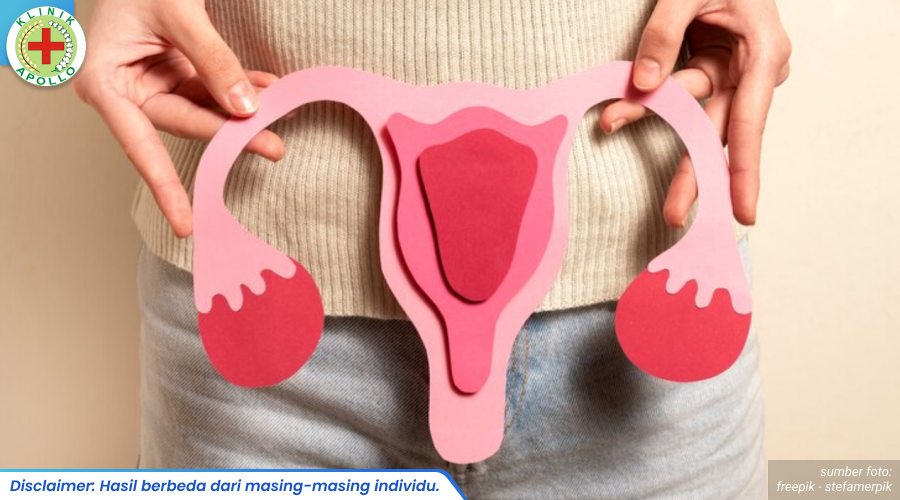 cara menyembuhkan kista bartholin 2_1_11zon