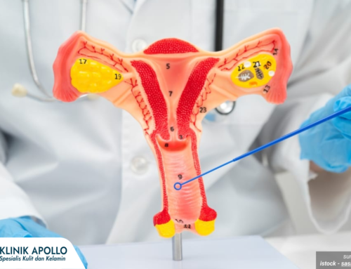 Ingin Lebih Kencang dan Percaya Diri? Ini Cara Merapatkan Daerah Kewanitaan yang Aman!