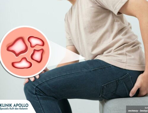 Muncul Luka Kecil Tak Sakit di Mr. P? Waspada Bisa Jadi Ini Ciri Awal Sifilis Pria!