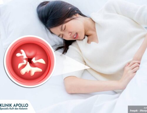 Keputihan Akibat Gonore, Apakah Selalu Disertai Bau Tak Sedap?