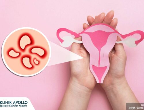 Muncul Luka di Miss V pada Remaja, Apa yang Perlu Diketahui? Cek Faktanya!