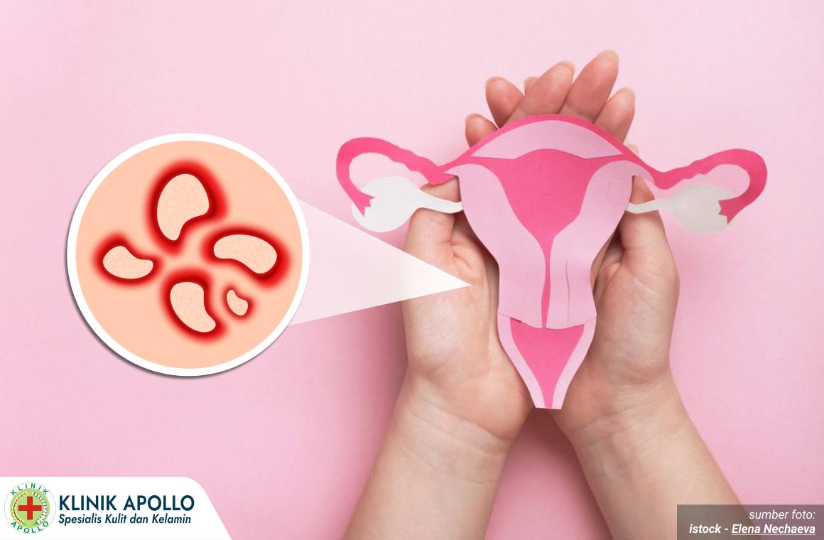 luka di miss v 1 - klinikutamasentosa.net_2_11zon