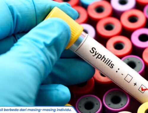 Tes Infeksi Sifilis: Kapan Waktu yang Tepat untuk Melakukannya? Cek Penjelasan Dokter!