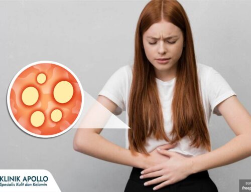 Jangan Diabaikan! Luka Lecet pada Kemaluan Wanita Bisa Jadi Tanda Penyakit Ini