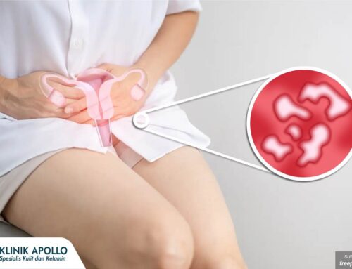 Sering Diabaikan! Begini Cara Dokter Mengobati Luka di Vagina yang Tepat